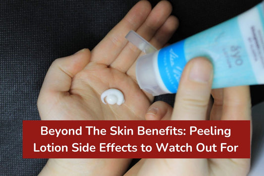 Beyond The Skin Benefits: Peeling Lotion Side Effects to Watch Out For
