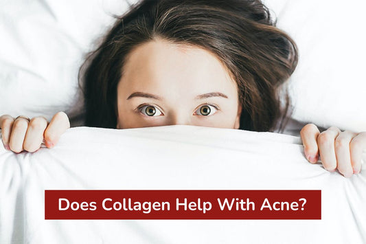 Does Collagen Help With Acne?