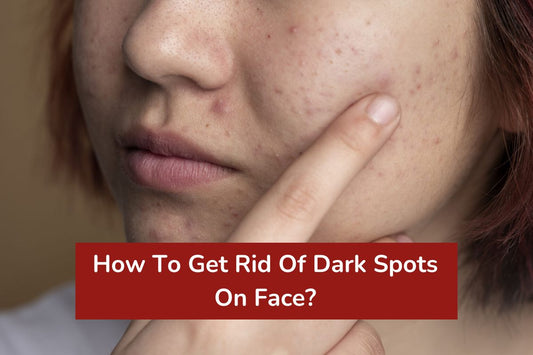 How To Get Rid Of Dark Spots On Face