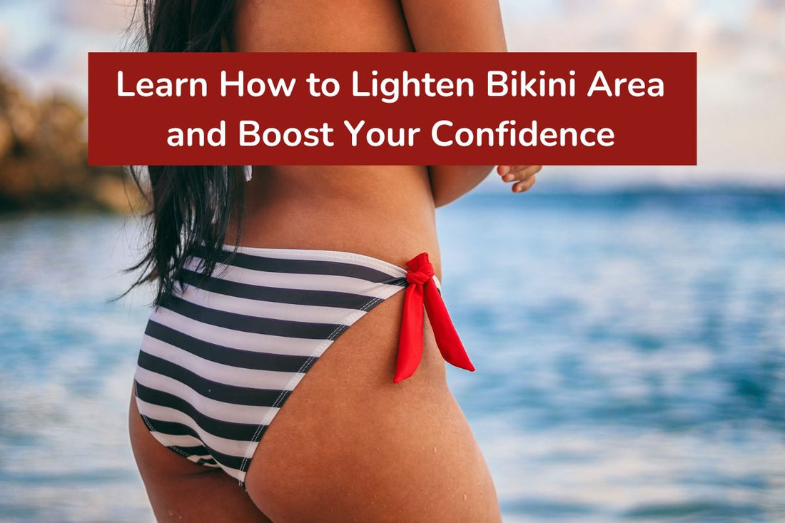 Learn How to Lighten Bikini Area and Boost Your Confidence